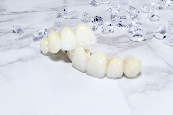 審美治療で使用する素材の種類