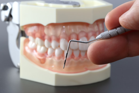 調布市で歯周病の専門的な治療を行っています