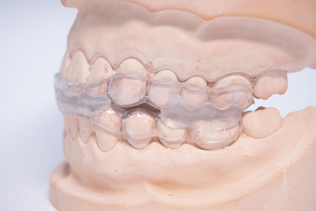 スリープスプリント（睡眠時無呼吸症候群治療）